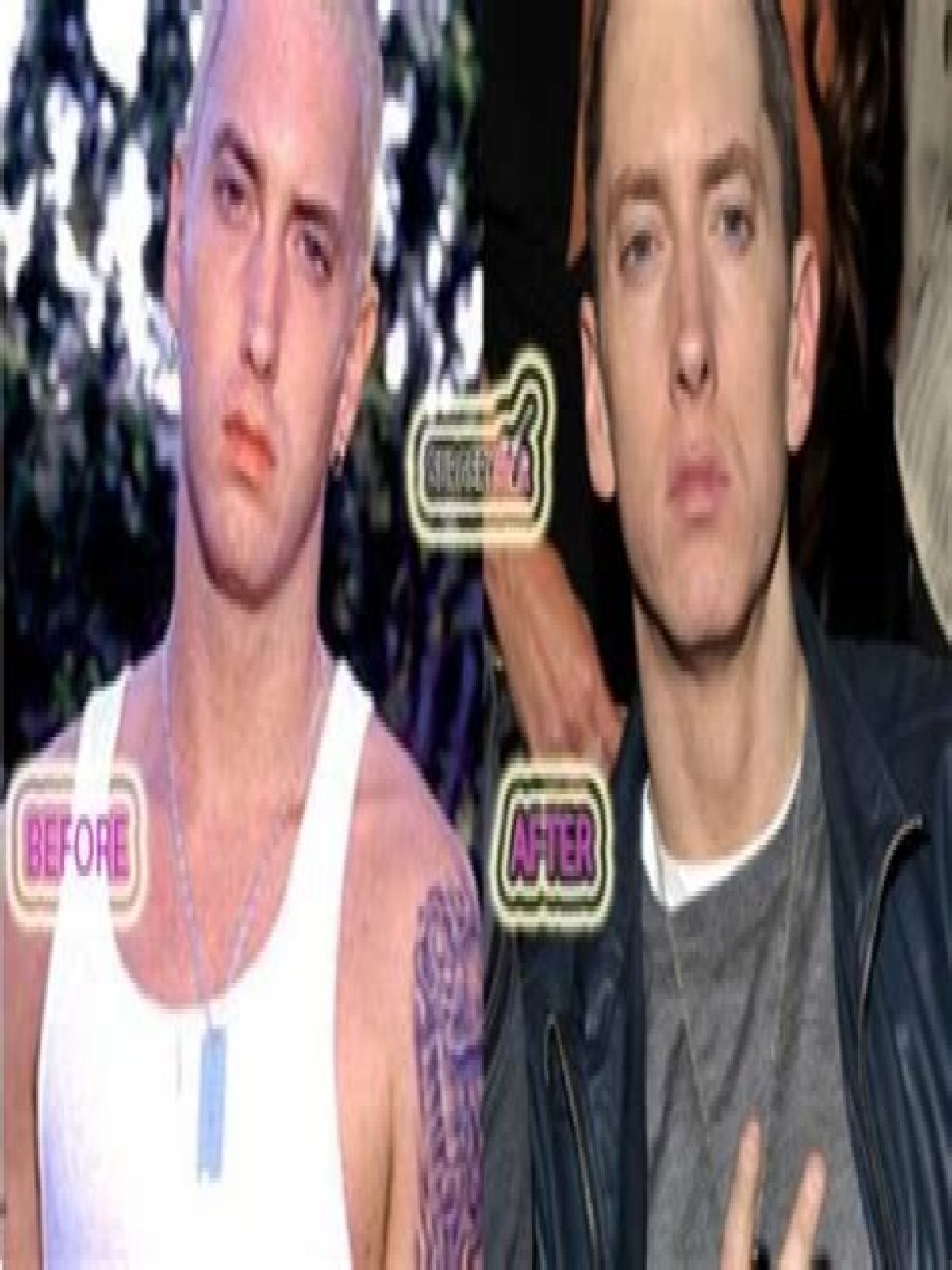 Eminem's Plastic Surgery Journey Revealed