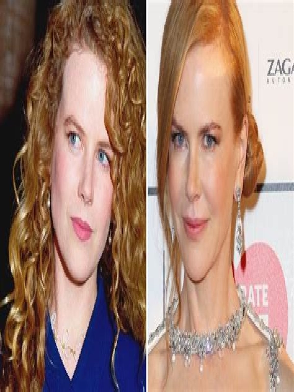 Has Nicole Kidman Had A Boob Job? Unraveling The Truth Behind The Rumors